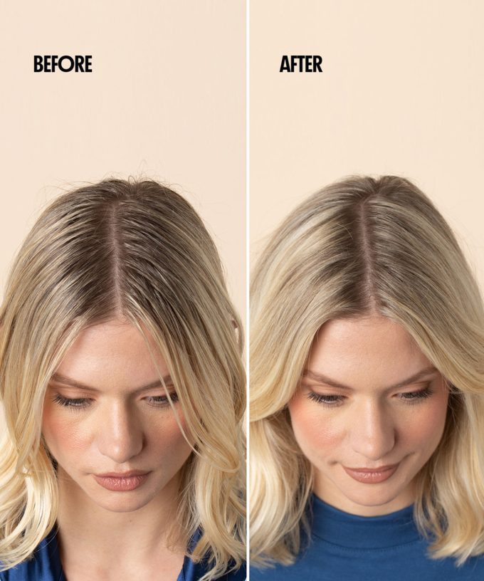 Dry Shampoo