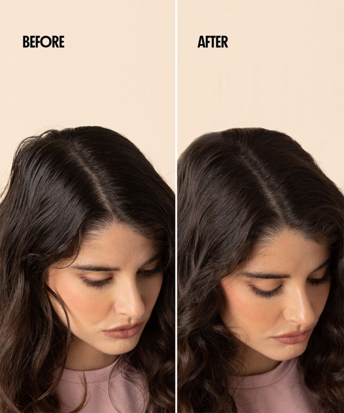 Dry Shampoo